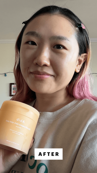 Sarah Han after using the Abib Glutathiosome Dark Spot Pads